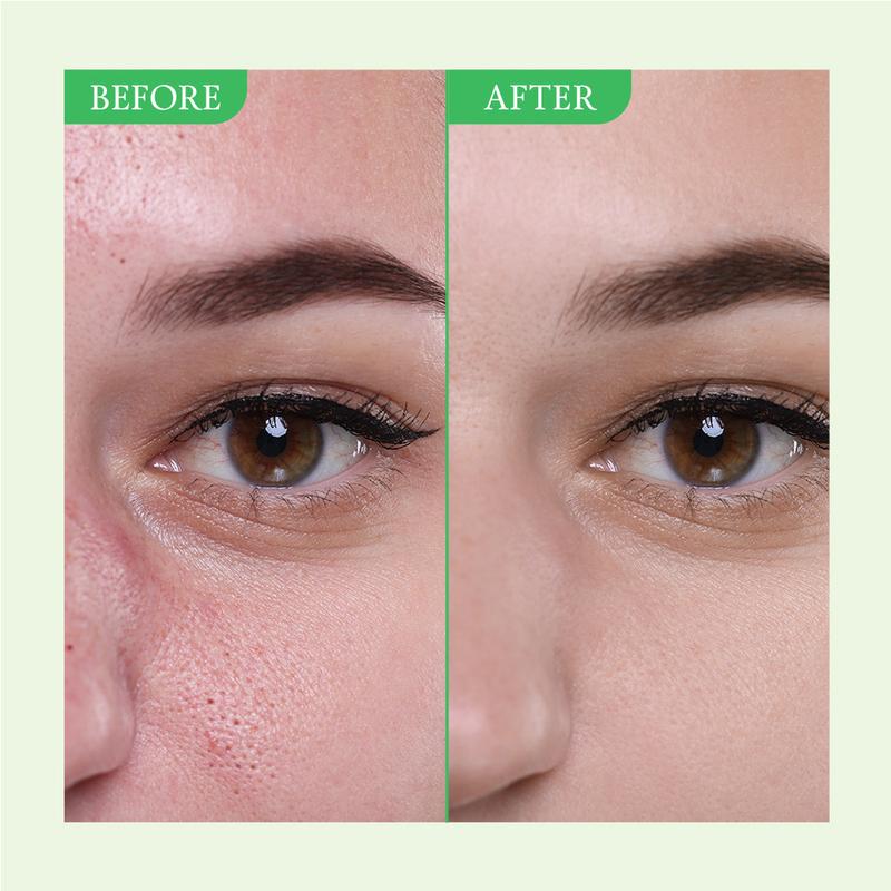 Sparra™- Green Tomato Clay Mask